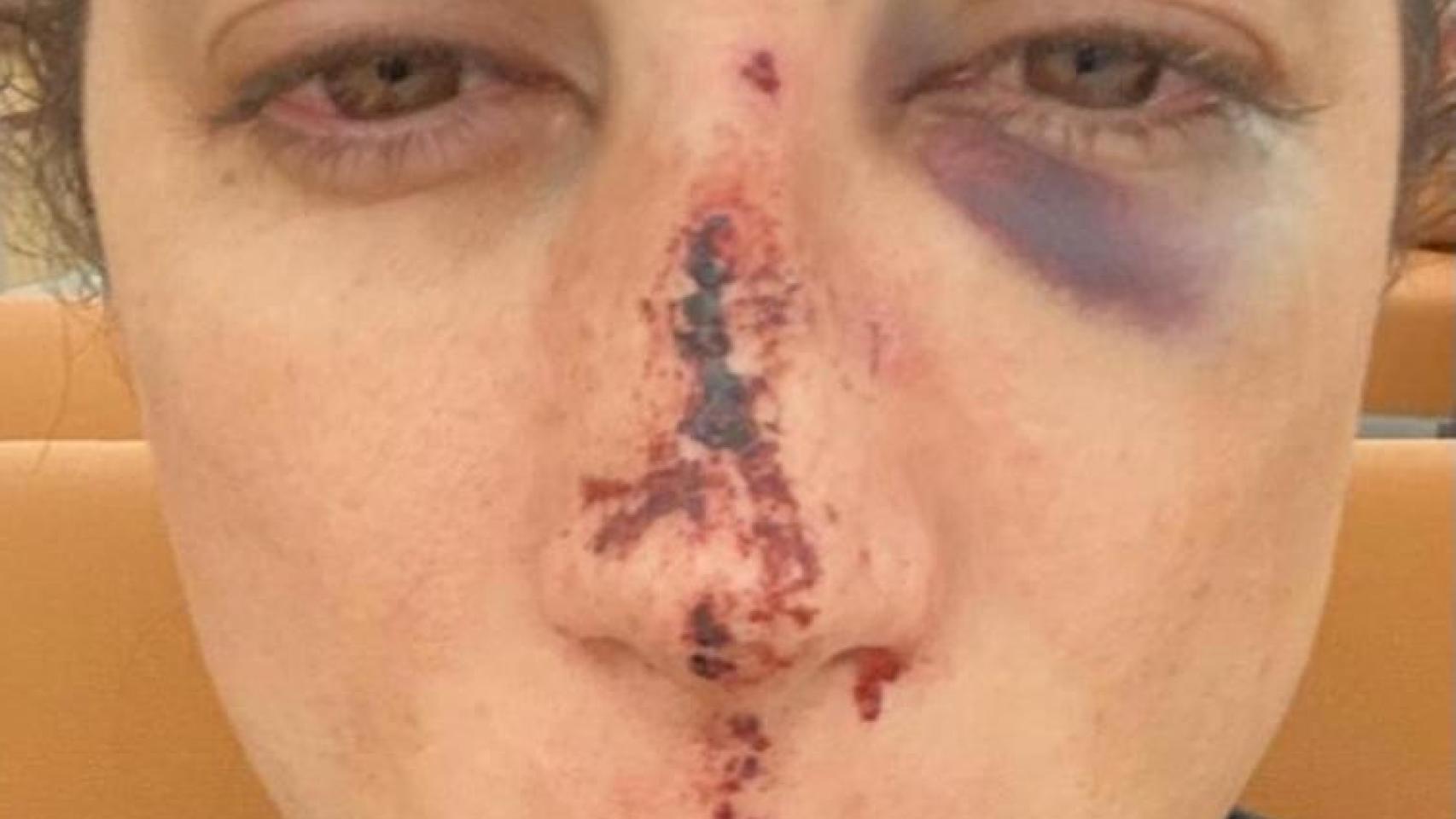 Así quedó el rostro.