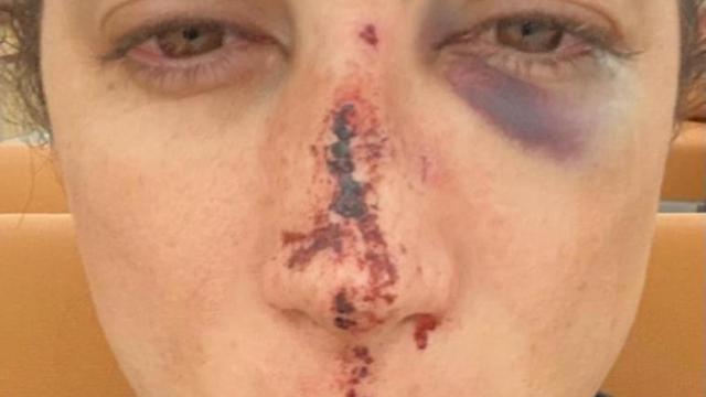 Así quedó el rostro.