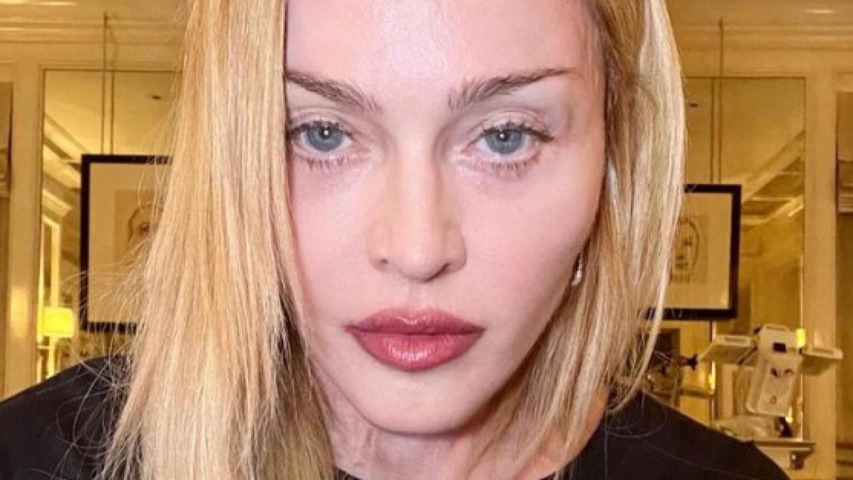 Primera fotografía de Madonna publicada en su cuenta de Instagram tras su hospitalización.