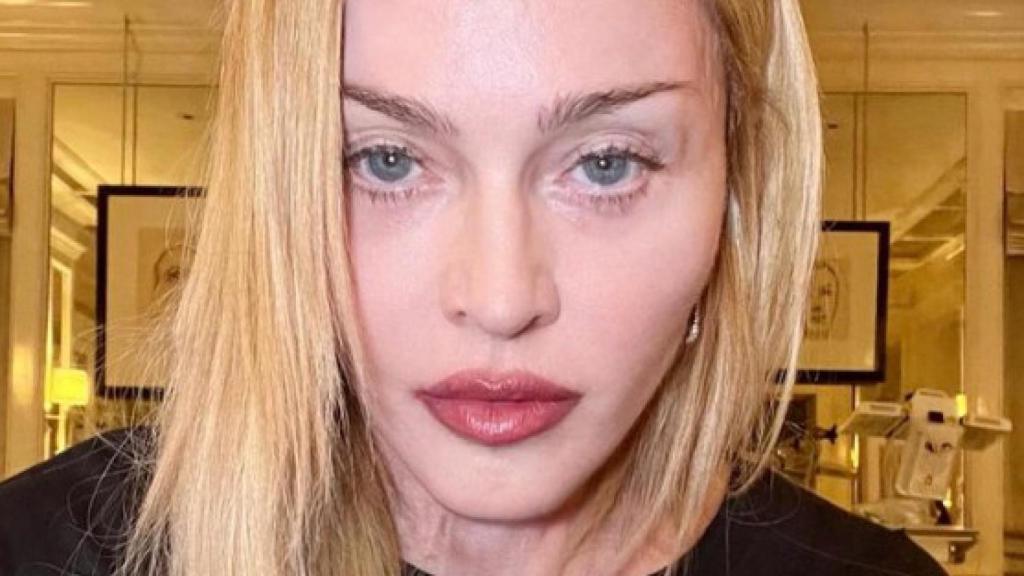 Primera fotografía de Madonna publicada en su cuenta de Instagram tras su hospitalización.