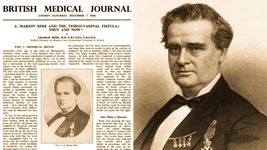 J Marion Sims junto a un artículo sobre sus hallazgos  en The Brithis Medical Journal.
