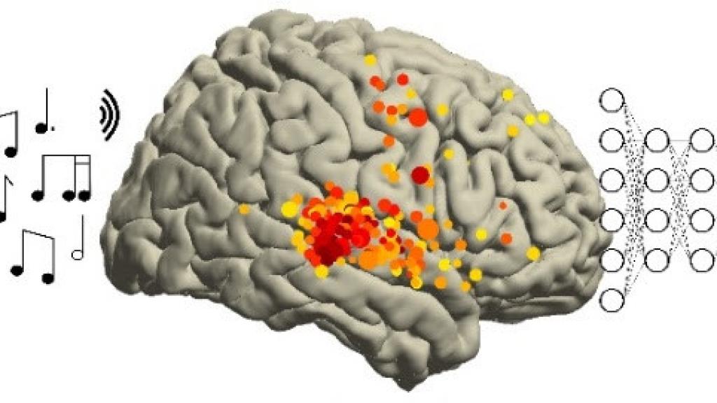 Pink Floyd en el cerebro humano. Foto: 'Plos Biology'