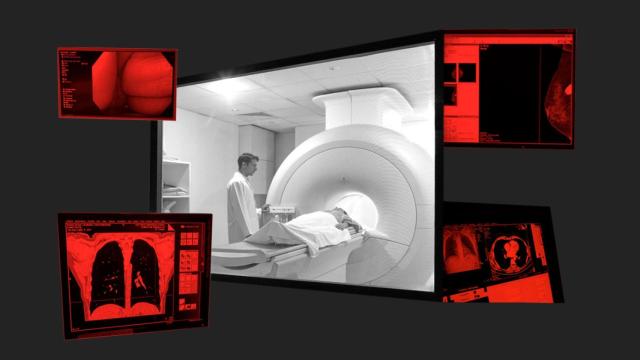 Un mega-estudio concluye que las pruebas masivas para detectar el cáncer apenas salvan vidas ESPNWS20230828_0366