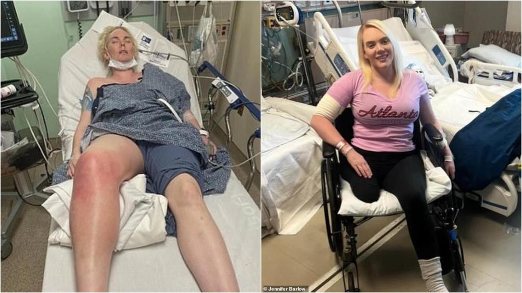 La modelo Jennifer Barlow durante su estancia en el hospital.