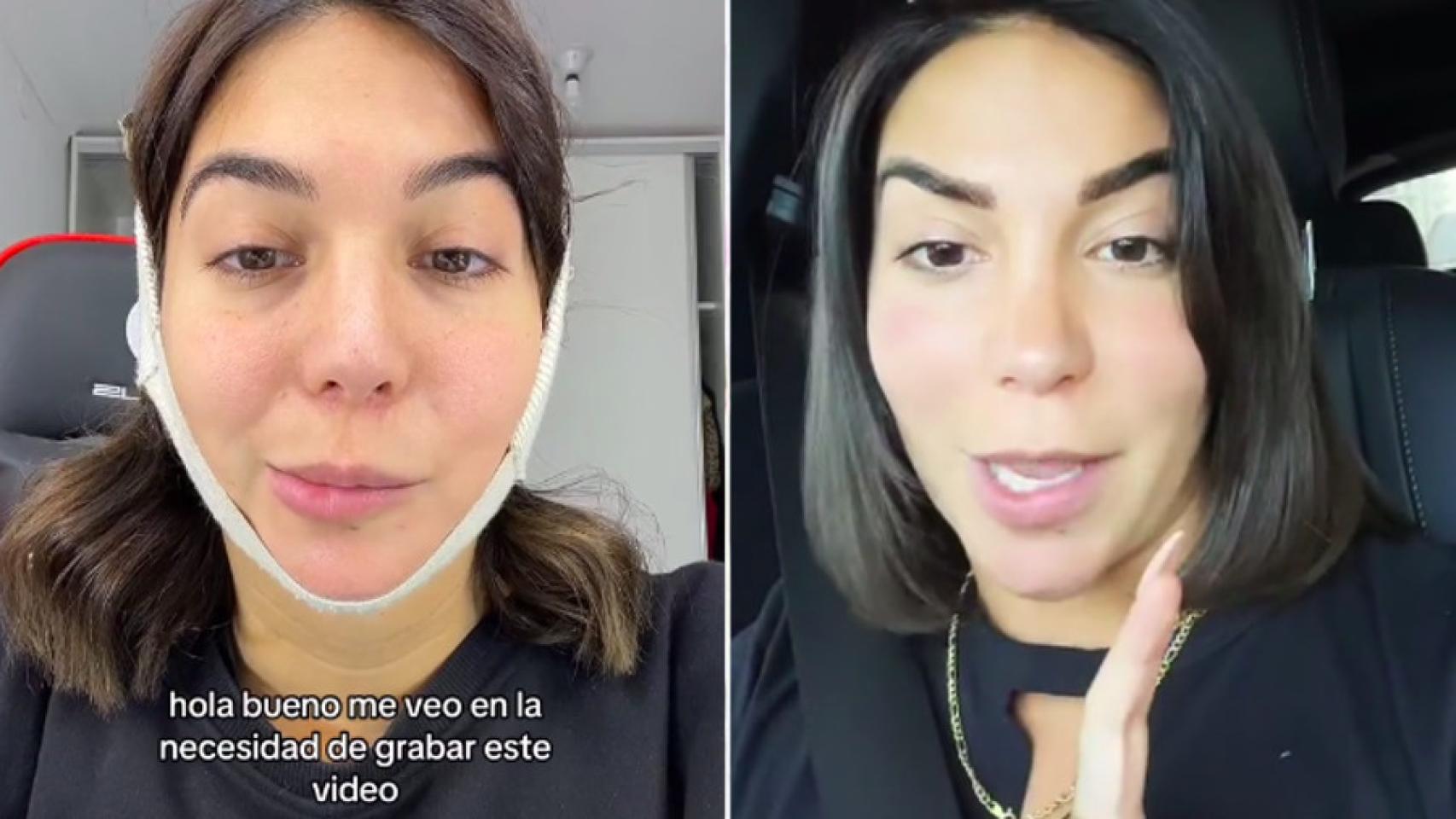 La 'influencer' en su imagen actual y antes de la parálisis.