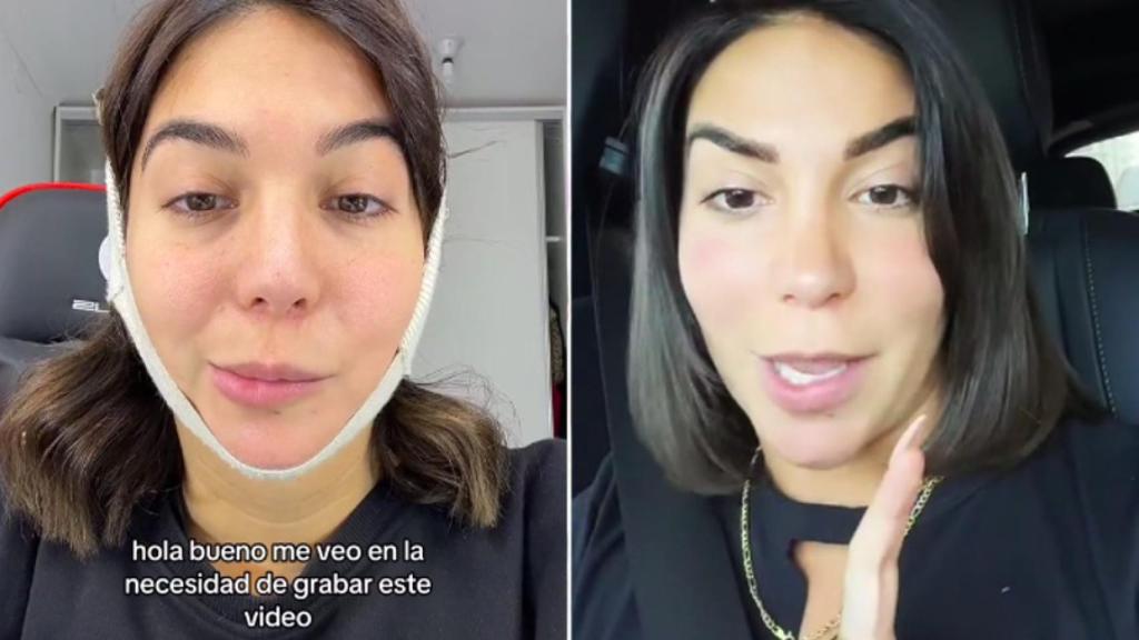 La 'influencer' en su imagen actual y antes de la parálisis.