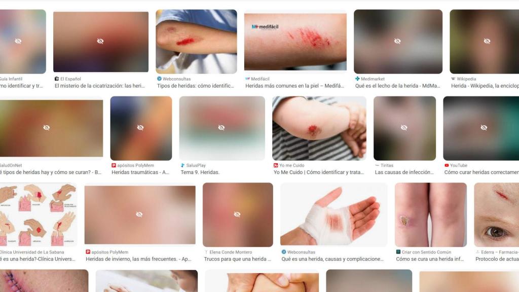 Google ahora muestra imágenes borrosas si son 'explícitas'