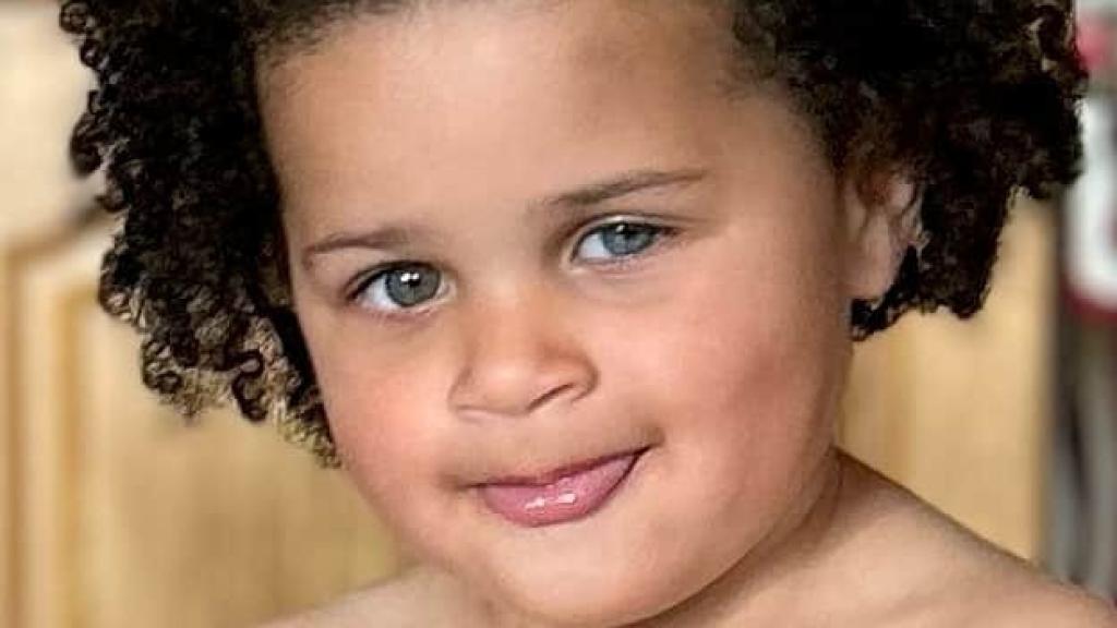 Amelia, la niña cuyo ojo tuvo que ser estirpado.