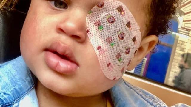 Amelia, la niña a la que tuvieron que extirpar un ojo.