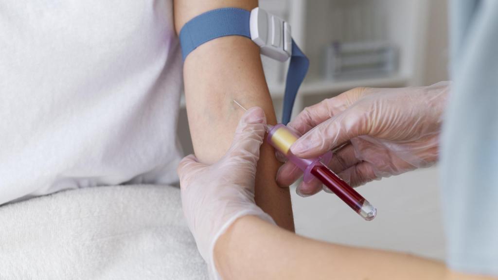 Momento durante una extracción de sangre.