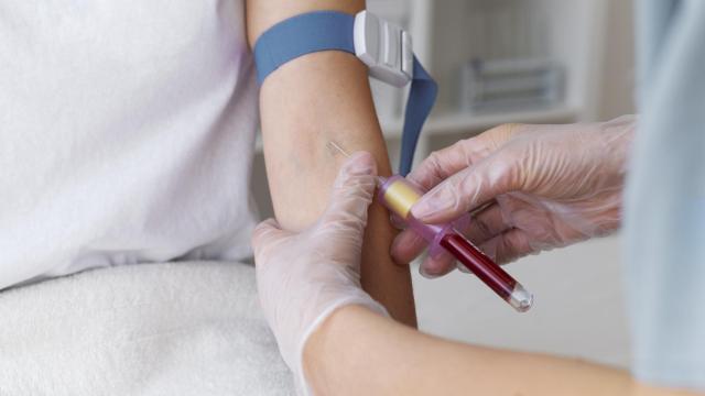 Momento durante una extracción de sangre.