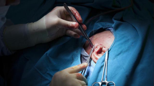 El catálogo de prestaciones de la Seguridad Social no incluye esta cirugía por motivos estéticos.