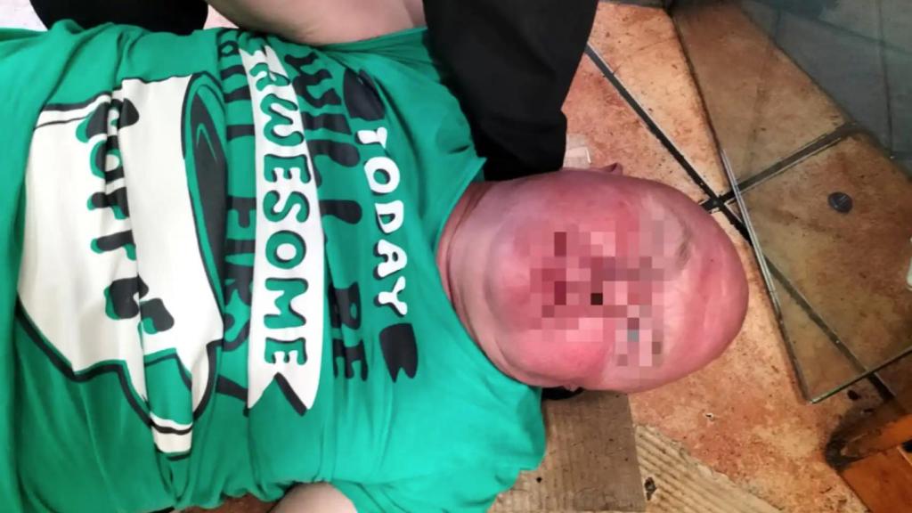 El detenido en Alicante fingiendo un infarto.