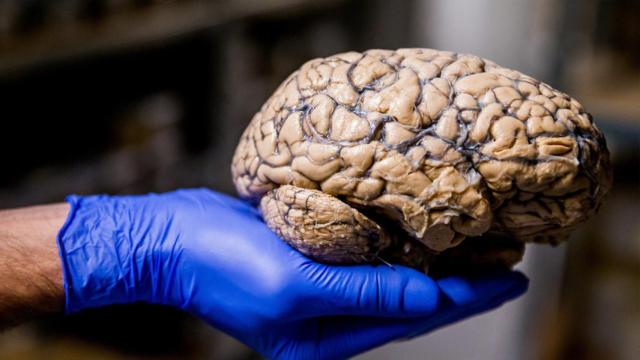 Diversos estudios apoyan que la dieta influye en la incidencia del alzhéimer.