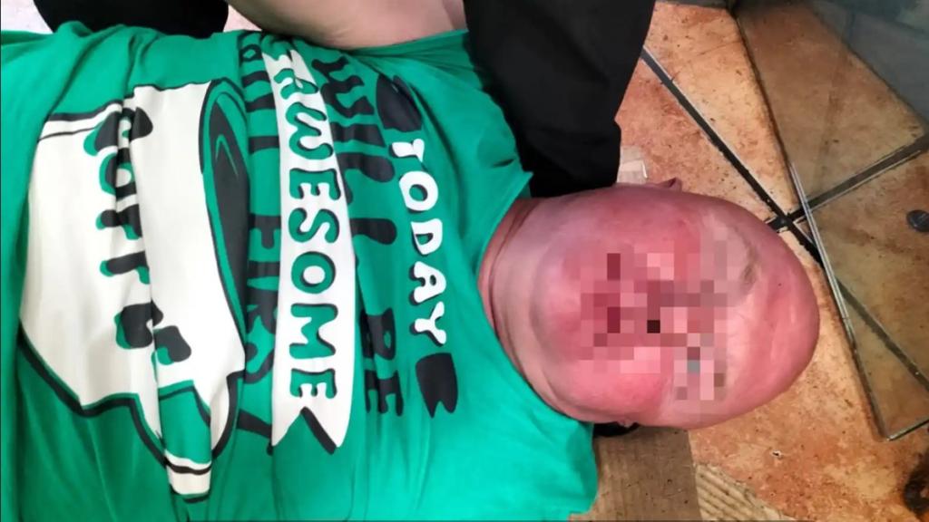 Una imagen del 'gastrojeta' echado en el suelo fingiendo un desmayo.
