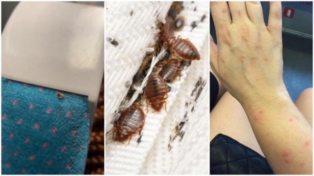 Una chinche en un asiento del metro de París (izquierda) y una pasajera con picaduras (derecha).