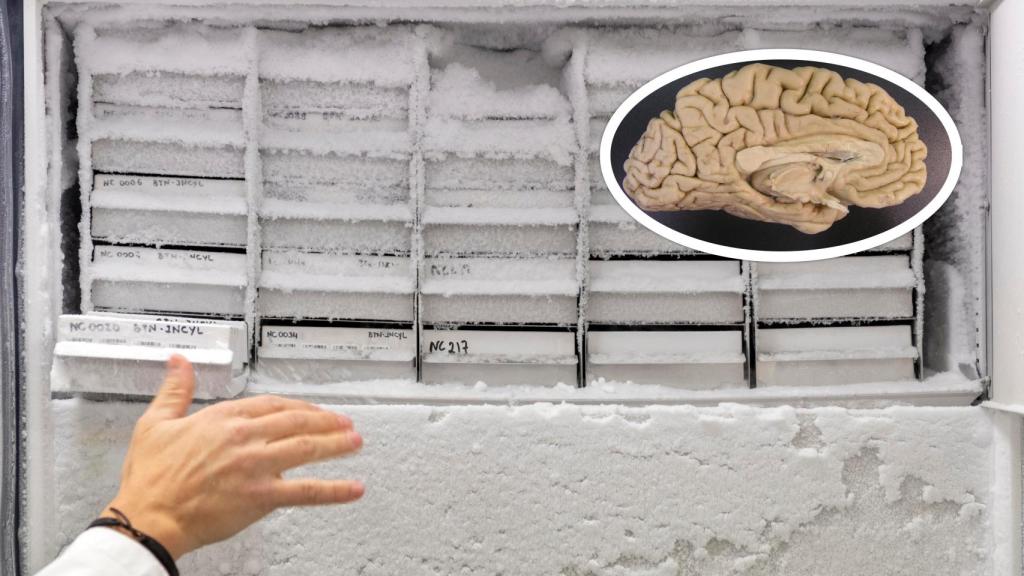 Imagen del banco de cerebros en Salamanca