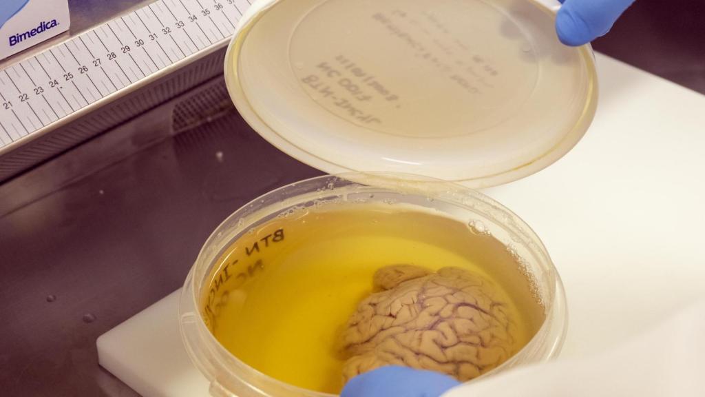 Cerebro conservado en formol en el banco de cerebros.