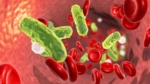 Desvelando el secreto de la sepsis: un descubrimiento, un método diagnóstico y una posible terapia