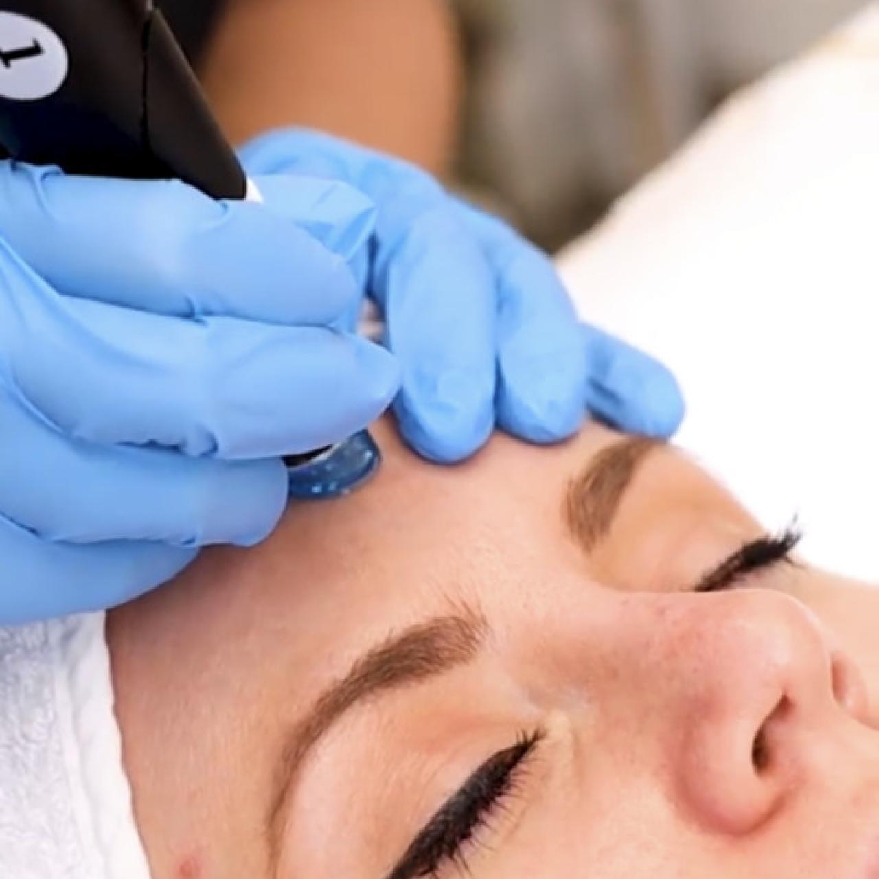 Tratamiento Hydrafacial Syndeo