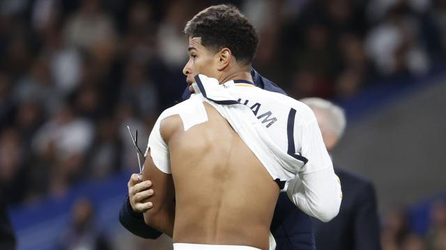 Jude Bellingham es atendido de su hombo izquierdo