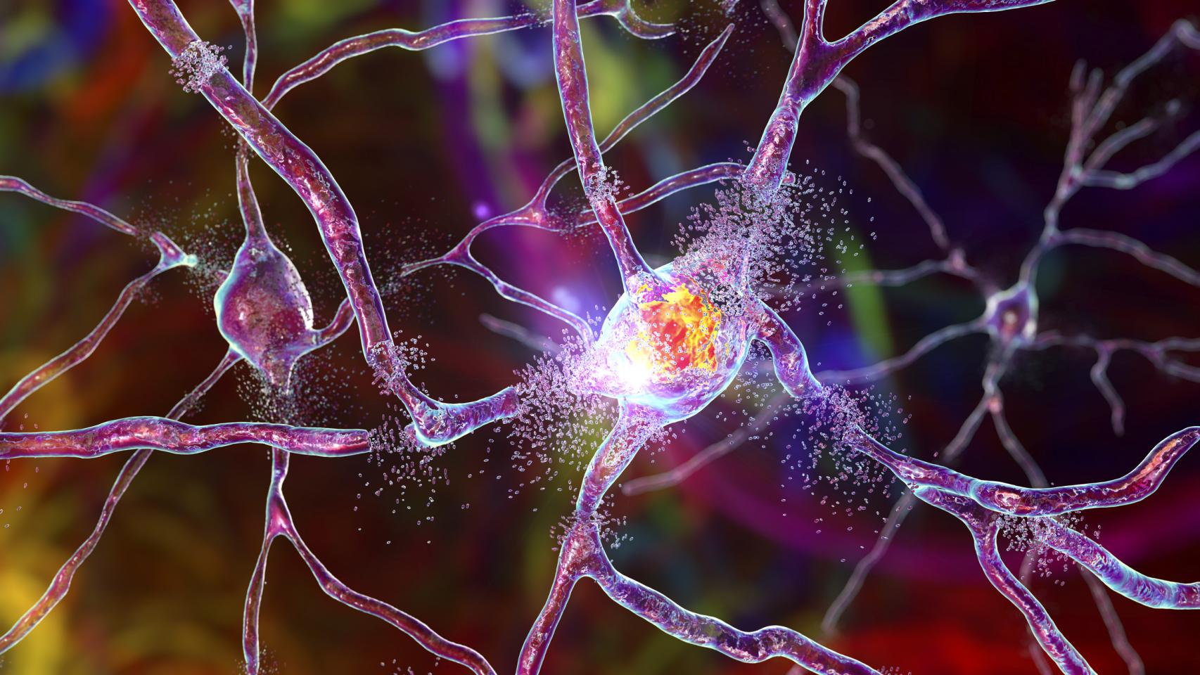 Ilustración conceptual en 3D de destrucción de neuronas.