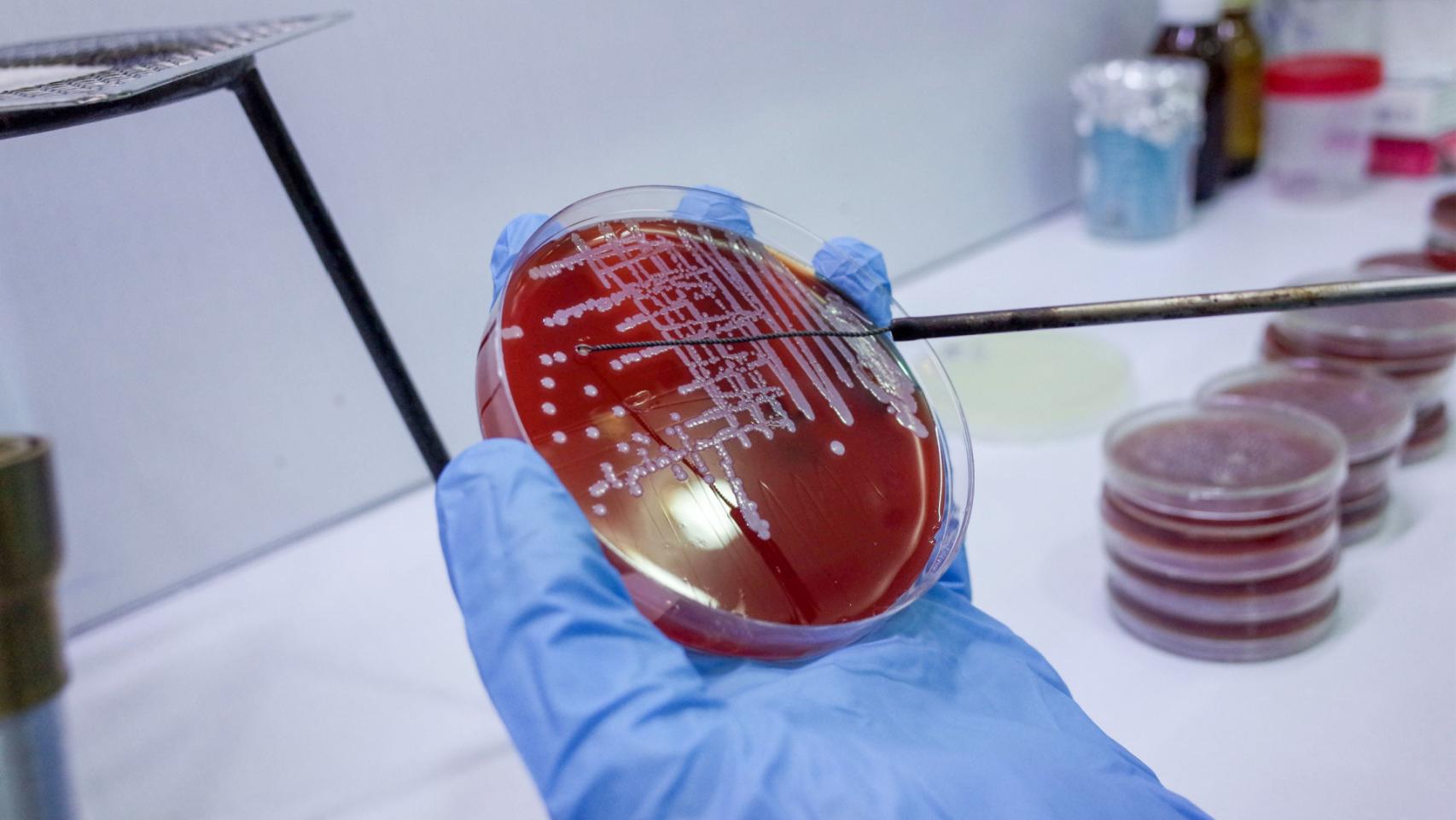 Crecimiento bacteriano.