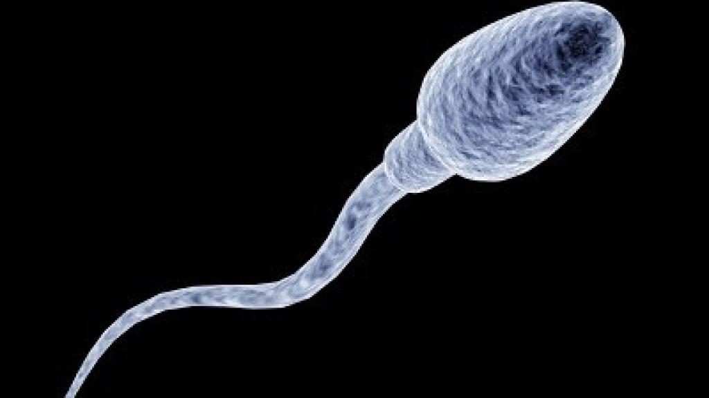 Imagen referencial de un espermatozoide.