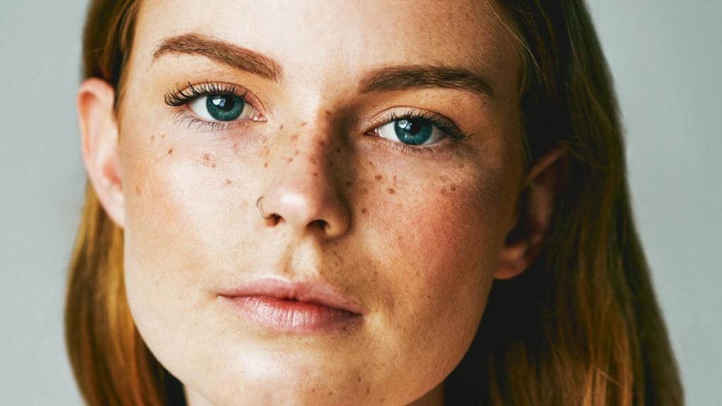 Una mujer, con pecas.