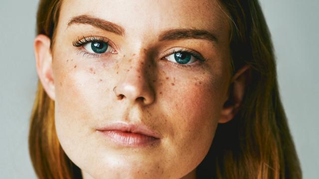 Una mujer, con pecas.