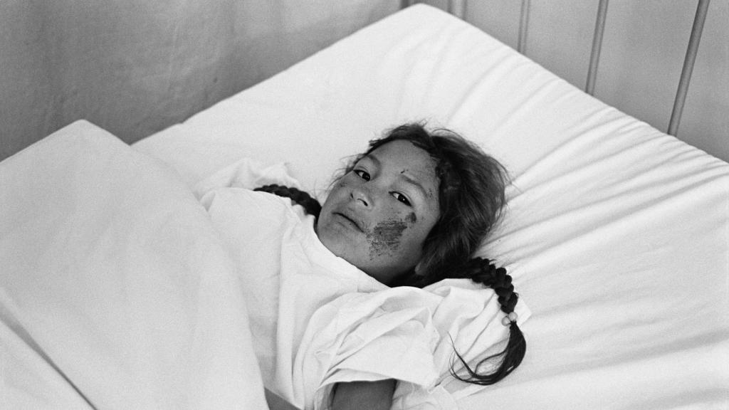 Isabel Azkarate: Herida por el grupo terrorista Sendero Luminoso en el Hospital de Huanta, localidad de Pampacancha. Perú, 1984. Kutxateka / Fondo Isabel Azkarate Funtsa