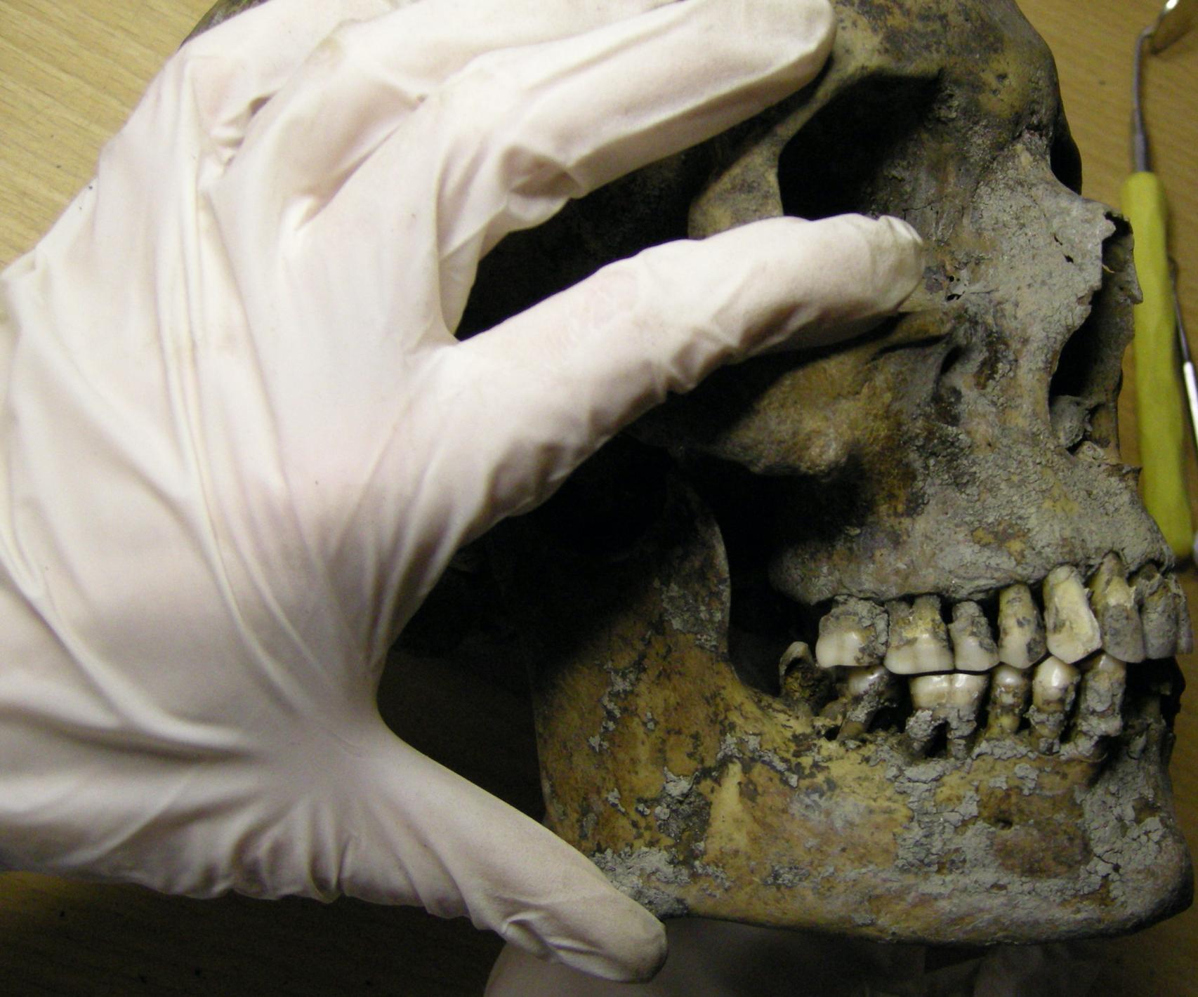 Examen de una mandíbula vikinga hallada en el yacimiento sueco.