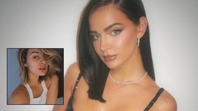 Laura Escanes habla de sus operaciones estéticas y desvela una carísima de la que no se arrepiente