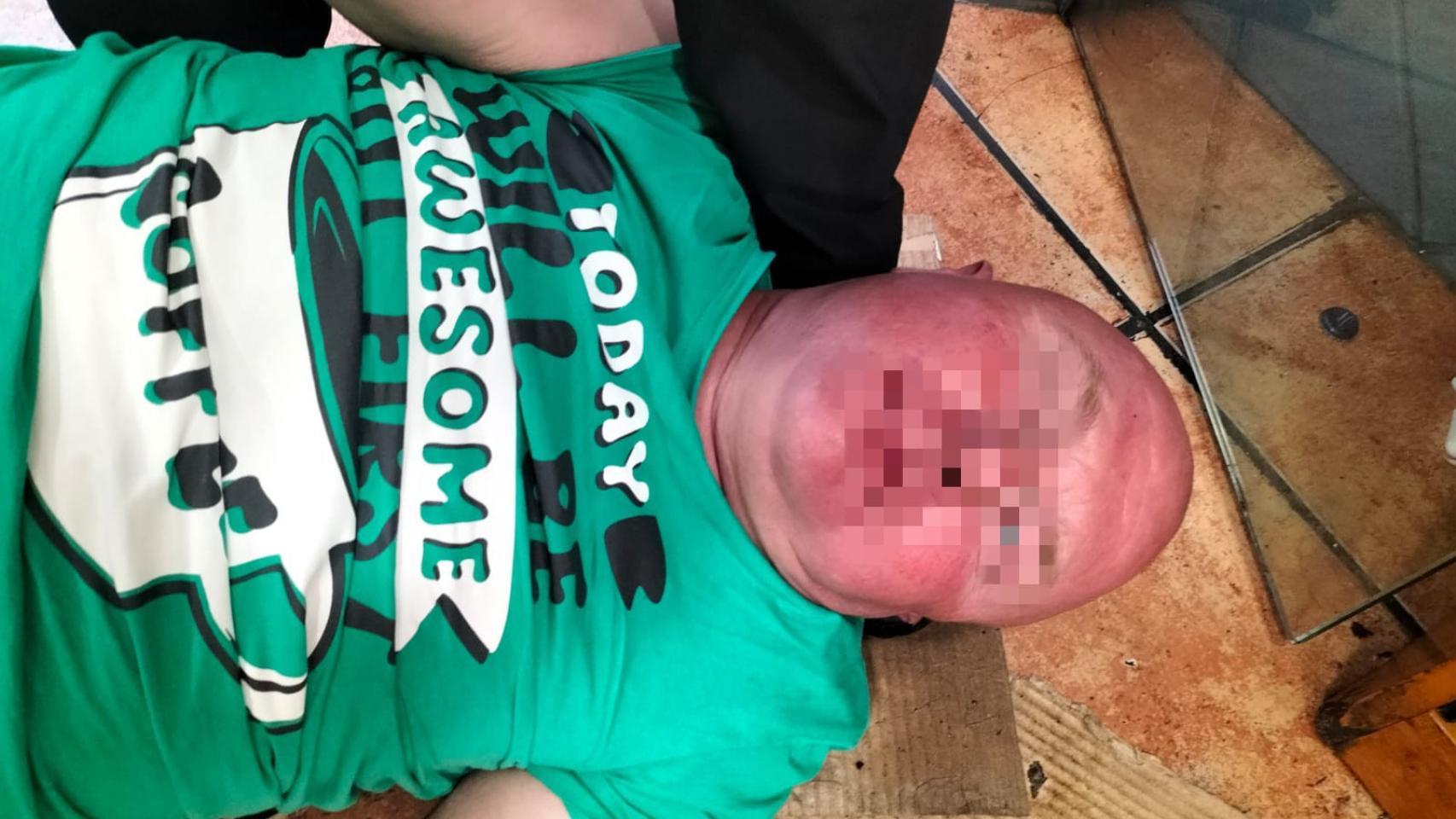 El 'gastrojeta', fingiendo un infarto en un restaurante de Alicante.