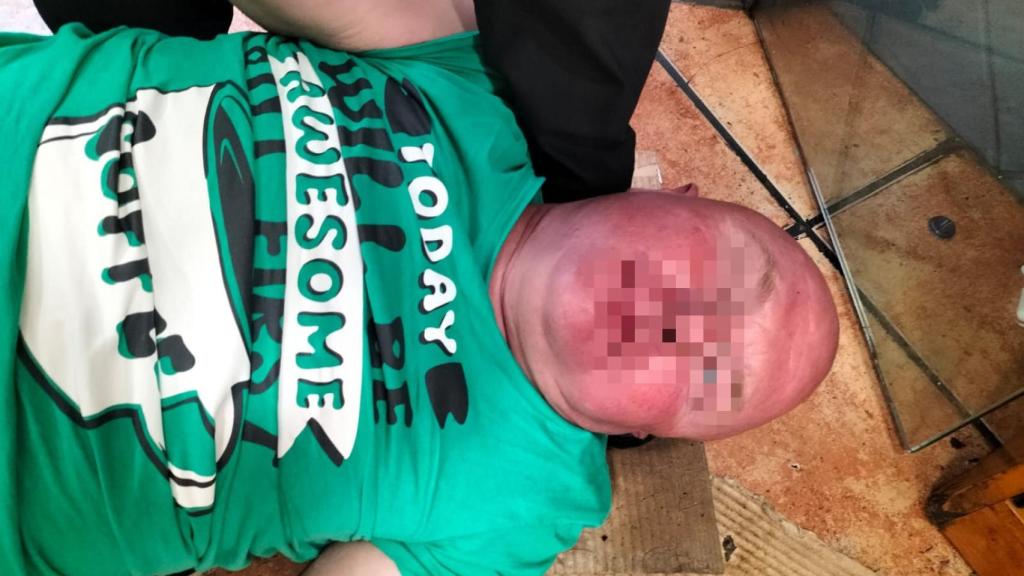 El 'gastrojeta', fingiendo un infarto en un restaurante de Alicante.