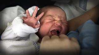 La disparatada moda en España de cortarle la lengua a los bebés para poder darles de mamar