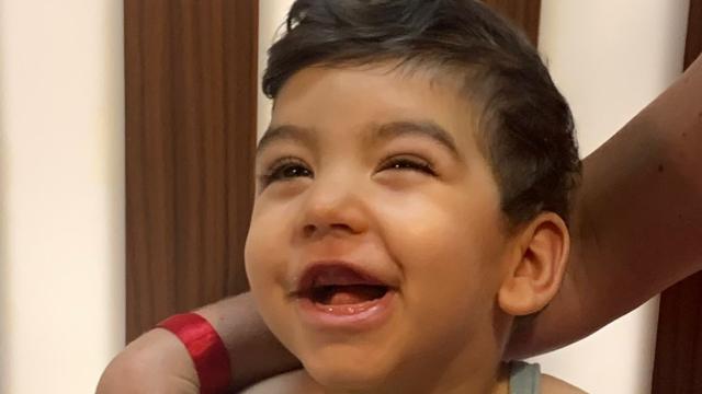 Leonel, el pequeño con encefalopatía epiléptica. EE