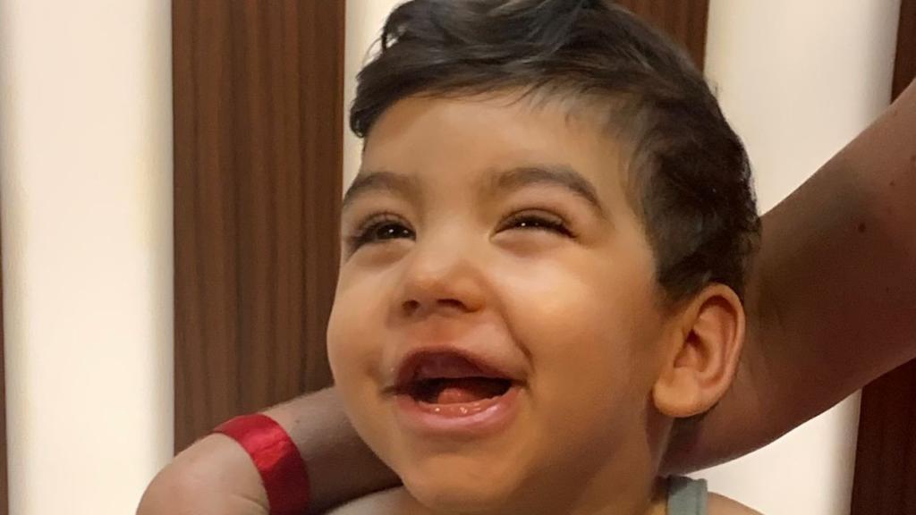Leonel, el pequeño con encefalopatía epiléptica. EE