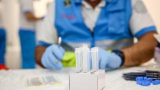 Material sanitario para la realización de test de antígenos.