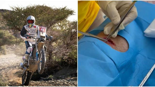 Javi Vega y su herida en el Rally Dakar 2024