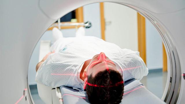 Hasta un 50% de los TAC craneales en urgencias son innecesarios: Nadie hace caso a las guías médicas