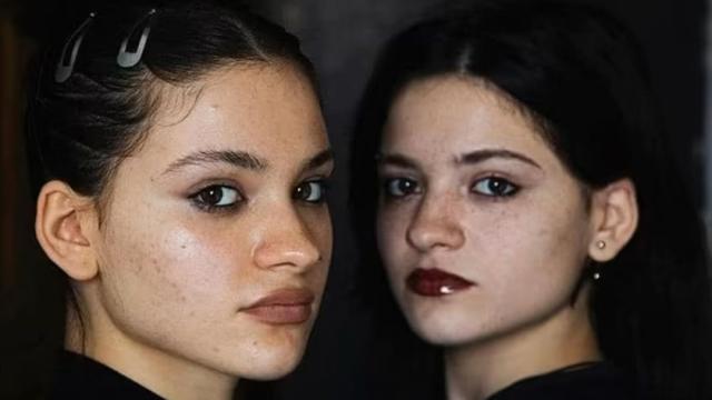 Amy Khvitia y Ano Sartania, gemelas robadas y vendidas de Georgia.