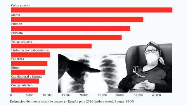 Estimación de nuevos casos de cáncer para 2024.