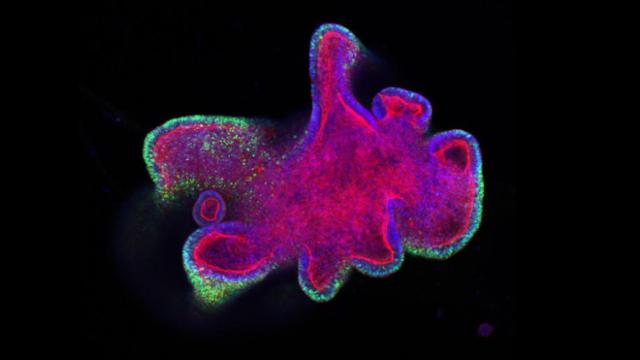 Vista de un organoide de cáncer al microscopio. Imagen: Karsten Boehnke/Lilly.