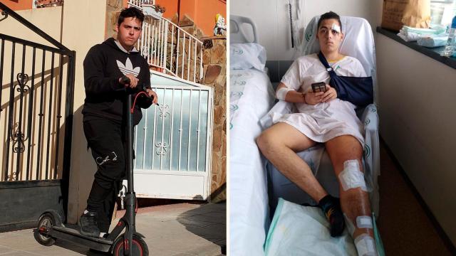 Adrián Ocaña García, este viernes, posando con su patinete eléctrico en la puerta de su casa en Belicena, junto a una imagen de 2022, hospitalizado tras ser atropellado por un coche.