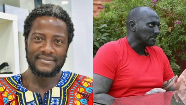 Bertrand Ndongo y el blanco que ahora es negro