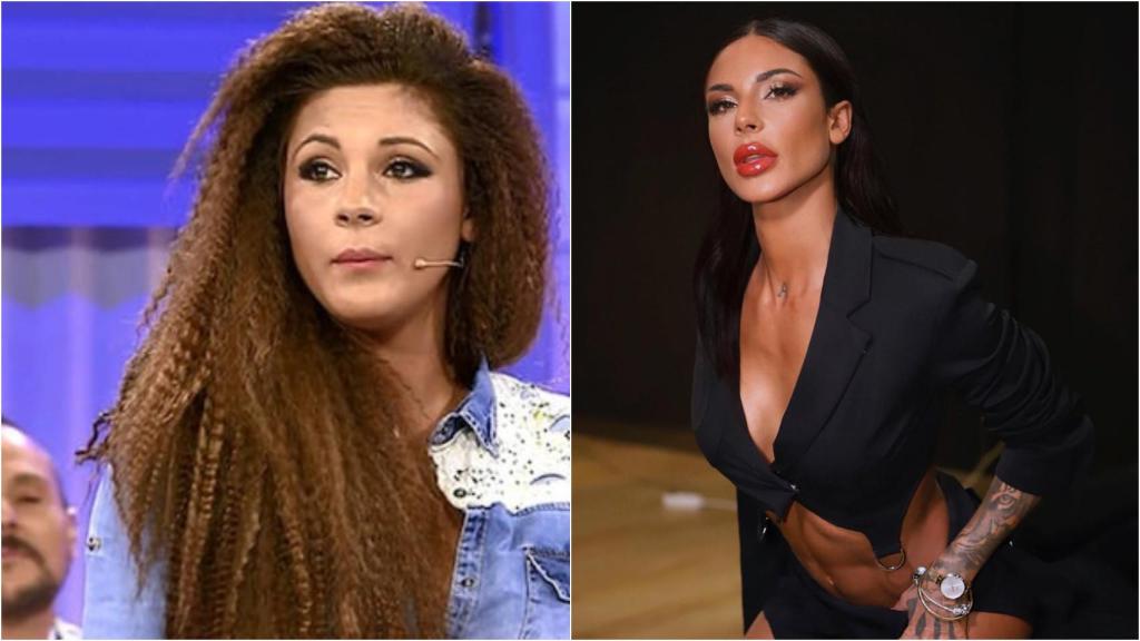 El antes y el después de Alba Casillas tras sus retoques.