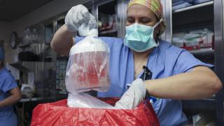 El primer trasplante de un riñón de cerdo abre una nueva esperanza a miles de pacientes en diálisis