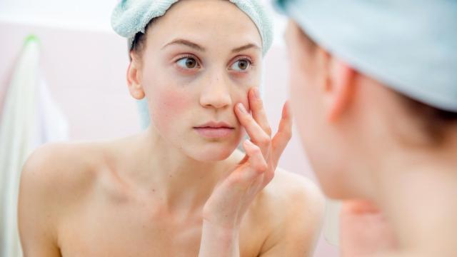 Qué es el face-icing: el sencillo truco de las famosas para acabar con las ojeras que triunfa en España.