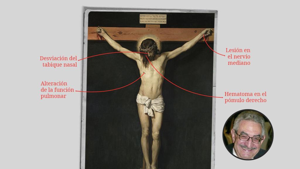Representación de las heridas que se han identificado por la Sábana Santa.